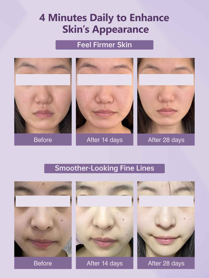 Beauty Wand for Eye, Face & Neck Lift & Firm with Light & EMS