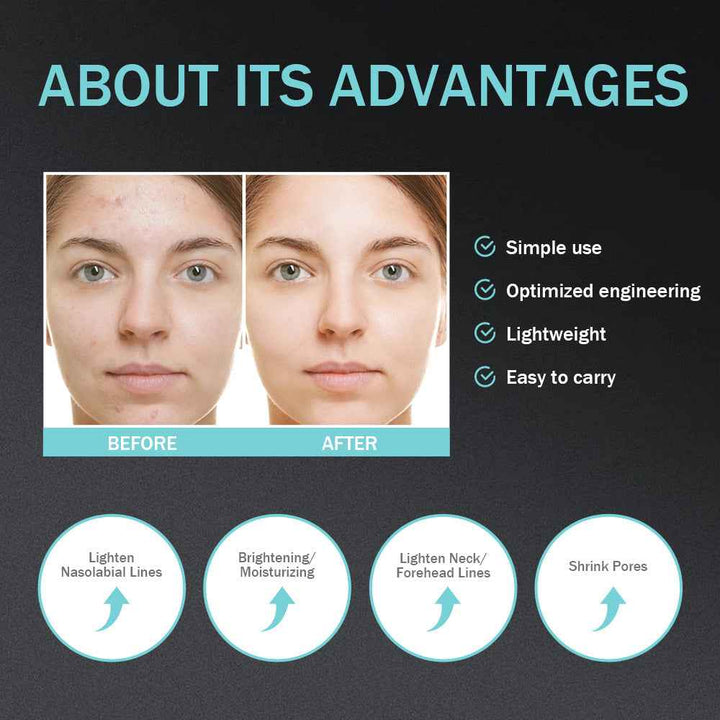 Blue Light Facial Device – EMS Microcurrent & Pore Tightening Tool