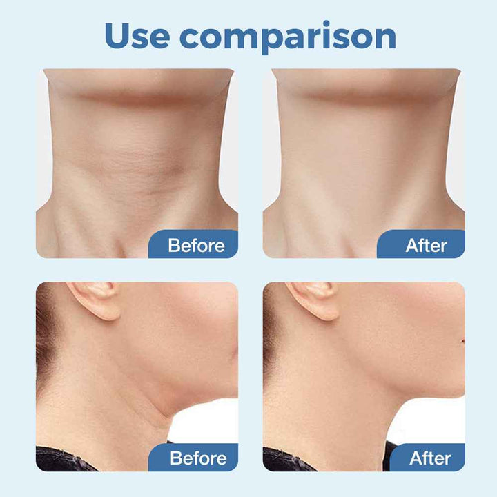 EMS Neck & Face Massager with LED & Microcurrent Therapy