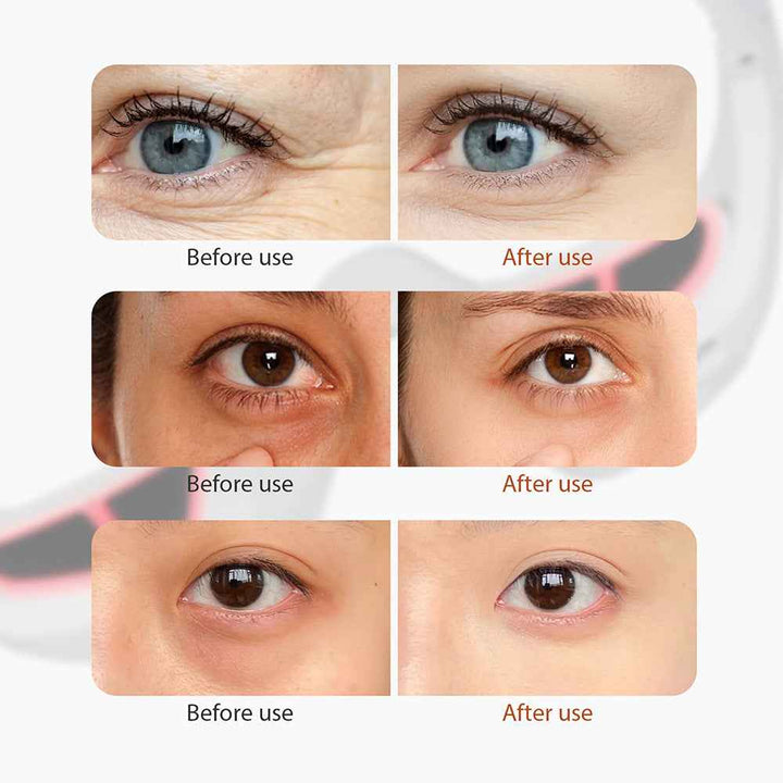 EMS Red Light Eye Massager for Dark Circles & Wrinkles