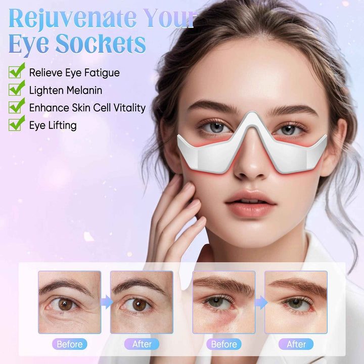 Eye Massager with Light Therapy – Relieves Bags, Fatigue and Circles
