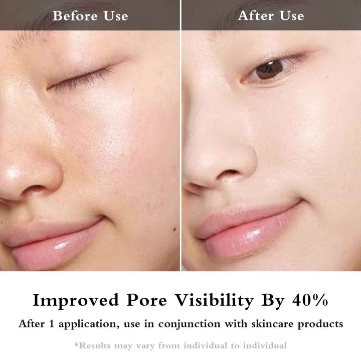 LED EMS Face and Eye Massager Anti-Aging Skin Rejuvenation Device