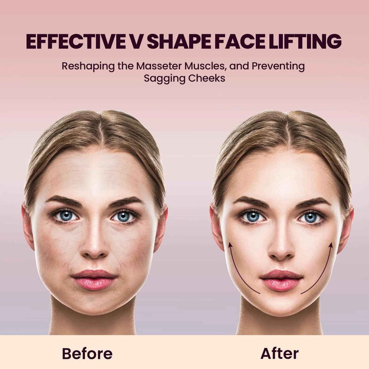 Microcurrent V-Face Lifting Device – 8 Modes, 15 Intensities