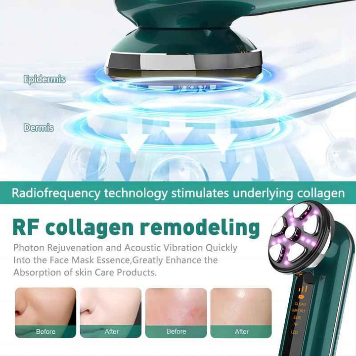 RF Microcurrent Facial Massager – EMS Lifting Beauty Device
