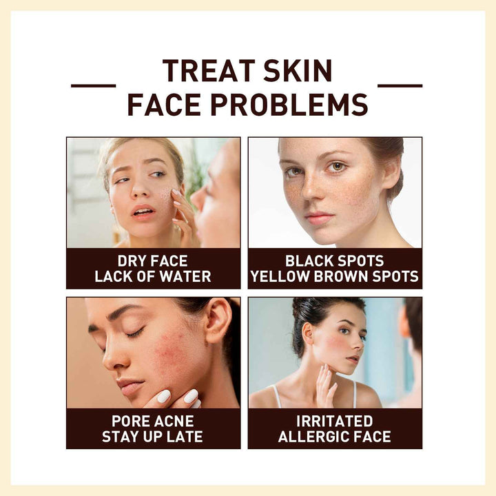 Rice Hydrating and Firming Essence – Face Repair Serum