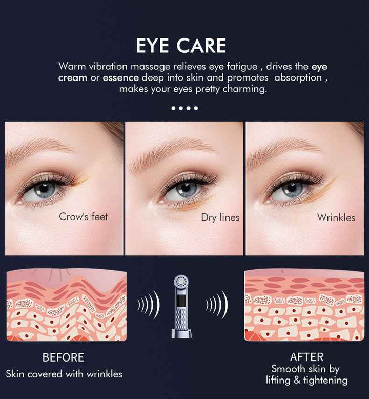 Ultrasonic Ice Therapy Facial Device – Wrinkle Removal & Skin Lifting